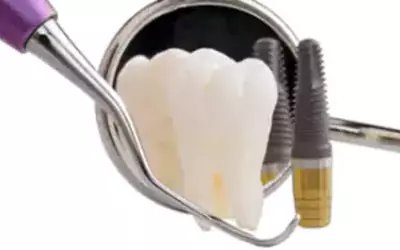 Affordable Dental Implants Cost Melbourne